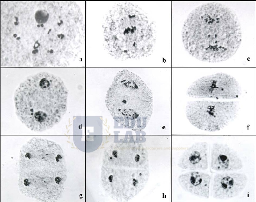 Chromosomes (400x)