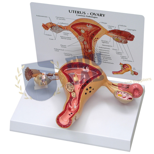 Uterus Model